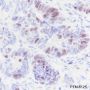 Anti-Aurora B Rabbit mAb