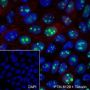 Anti-NPM1 Rabbit mAb