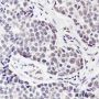 Anti-CDK4 Rabbit mAb