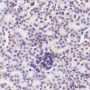 Anti-CDK4 Rabbit mAb
