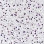 Anti-CDK4 Rabbit mAb