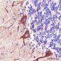 Anti-PAK3 Rabbit mAb