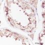Anti-TPPII Mouse mAb