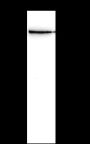 Anti-ROCK2 Rabbit mAb