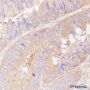 Anti-ROCK2 Rabbit mAb
