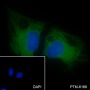 Anti-ROCK2 Rabbit mAb