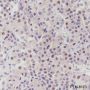 Anti-PITX2/RGS Rabbit mAb