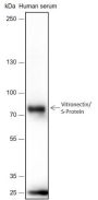 Anti-Vitronectin/S-Protein Rabbit mAb