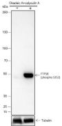 Anti-Phospho-PTP1B (Ser352) Rabbit mAb
