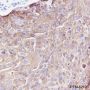 Anti-Keratin 13 Rabbit mAb