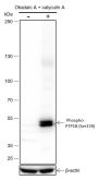 Anti-Phospho-PTP1B (Ser378) Rabbit mAb