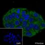 Anti-Lactoferrin Mouse mAb