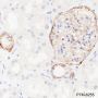 Anti-CD239/BCAM Rabbit mAb