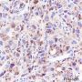 Anti-LDL Receptor Rabbit mAb