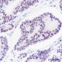 Anti-ERG Rabbit mAb