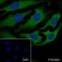 Anti-PKC alpha Rabbit mAb