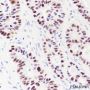 Anti-p53 Rabbit mAb