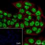 Anti-p53 Rabbit mAb
