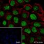 Anti-p53 Rabbit mAb