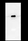 Anti-p53 Rabbit mAb