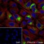 Anti-MUC5AC Mouse mAb