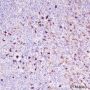Anti-S100A9 Rabbit mAb