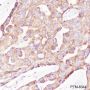 Anti-PTP1B Rabbit mAb