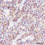 Anti-PTP1B Rabbit mAb