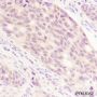 Anti-ADRM1 Mouse mAb