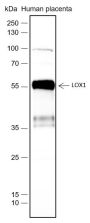 Anti-OLR1/LOX1 Rabbit mAb