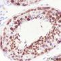 Anti-DDX4 Rabbit mAb