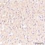 Anti-alpha Actinin 2 Rabbit mAb