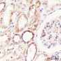 Anti-Calreticulin Rabbit mAb