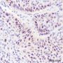 Anti-CDK2 Rabbit mAb