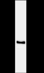 Anti-GNMT Mouse mAb