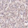 Anti-FABP1 Rabbit mAb