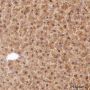 Anti-FABP1 Rabbit mAb