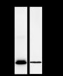 Anti-FABP4 Rabbit mAb