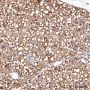 Anti-FABP4 Rabbit mAb