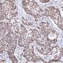 Anti-hnRNP H Mouse mAb