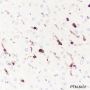 Anti-LILRB1 Rabbit mAb