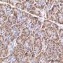 Anti-RPL26L1 Rabbit mAb