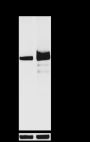 Anti-SQSTM1/p62 Rabbit mAb