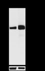 Anti-SQSTM1/p62 Rabbit mAb