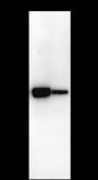 Anti-NSE Mouse mAb