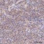 Anti-ROCK1 Mouse mAb