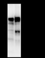 Anti-Prothrombin Rabbit mAb