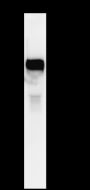Anti-Prothrombin Rabbit mAb