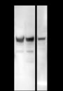 Anti-IL1RL1/ST2 Mouse mAb