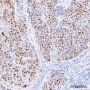 Anti-p21 Rabbit mAb